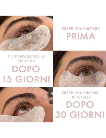 Siero ciglia e sopracciglia | Kalentin Italia